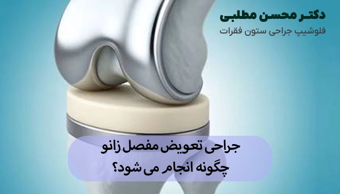 جراحی تعویض مفصل زانو چگونه انجام می شود؟
