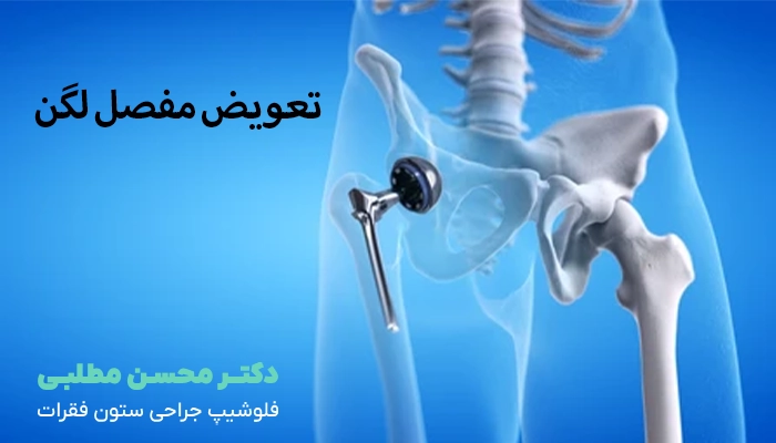 همه چیز درباره جراحی تعویض مفصل لگن