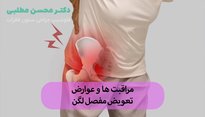 مراقبت های بعد از تعویض مفصل لگن