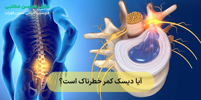 آیا دیسک کمر خطرناک است؟ بررسی کامل بیماری