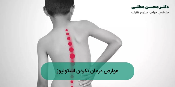عوارض درمان نکردن اسکولیوز