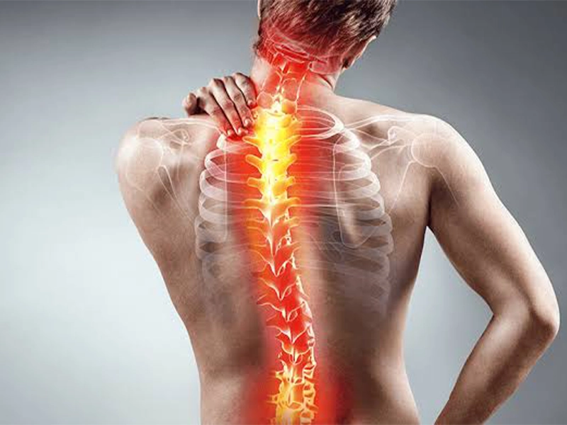 هزینه جراحی اسکولیوز