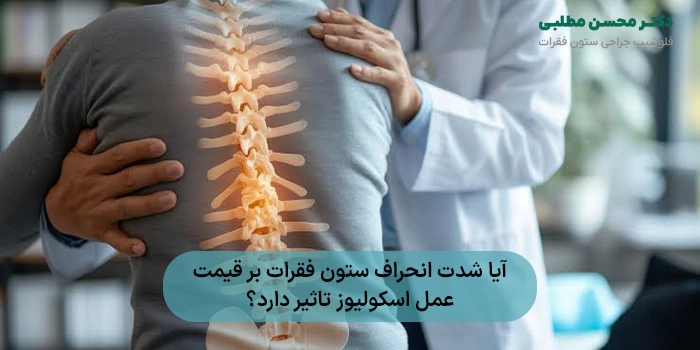 آیا شدت انحراف ستون فقرات بر قیمت عمل اسکولیوز تاثیر دارد؟