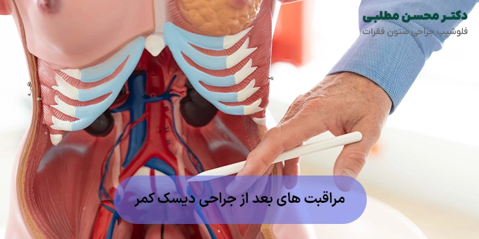 مراقبت های بعد از جراحی دیسک کمر + نکات مهم و ضروری