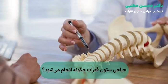 جراحی ستون فقرات چگونه انجام میشود؟