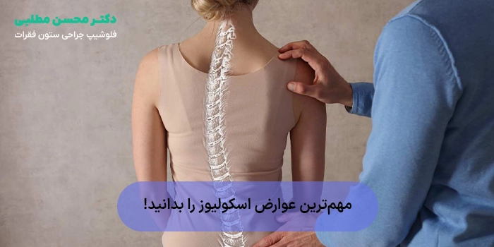 مهمترین عوارض اسکولیوز را بدانید!
