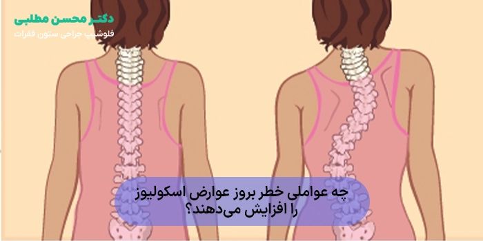 چه عواملی خطر بروز عوارض اسکولیوز را افزایش میدهند؟