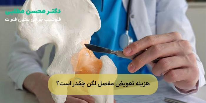 هزینه تعویض مفصل لگن