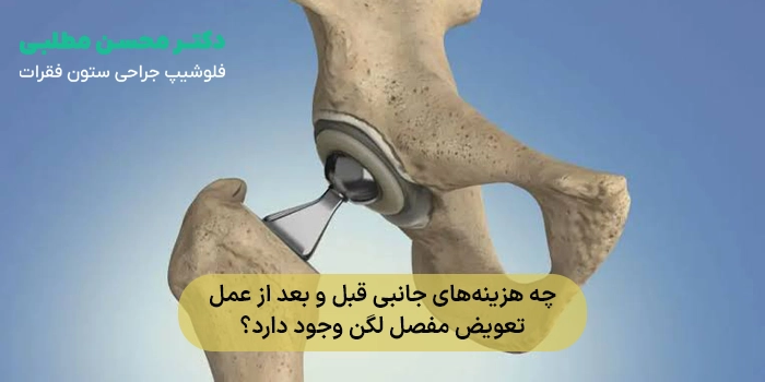 چه هزینههای جانبی قبل و بعد از عمل تعویض مفصل لگن وجود دارد؟