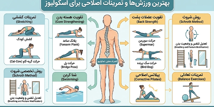 چه ورزشهایی برای اسکولیوز ممنوع یا نامناسب هستند؟