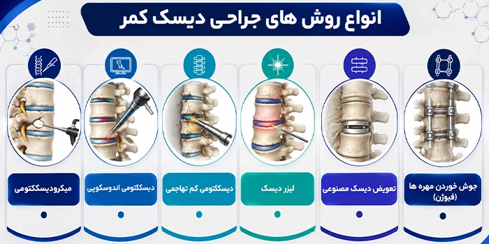 انواع روشهای جراحی دیسک کمر